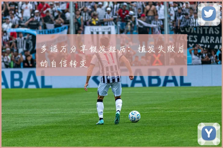 多诺万分享假发经历：植发失败后的自信转变